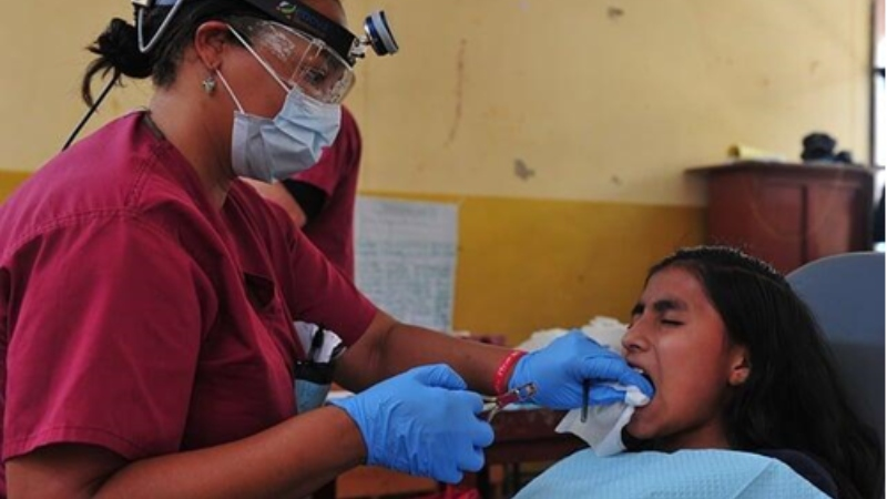 Tooth Extraction